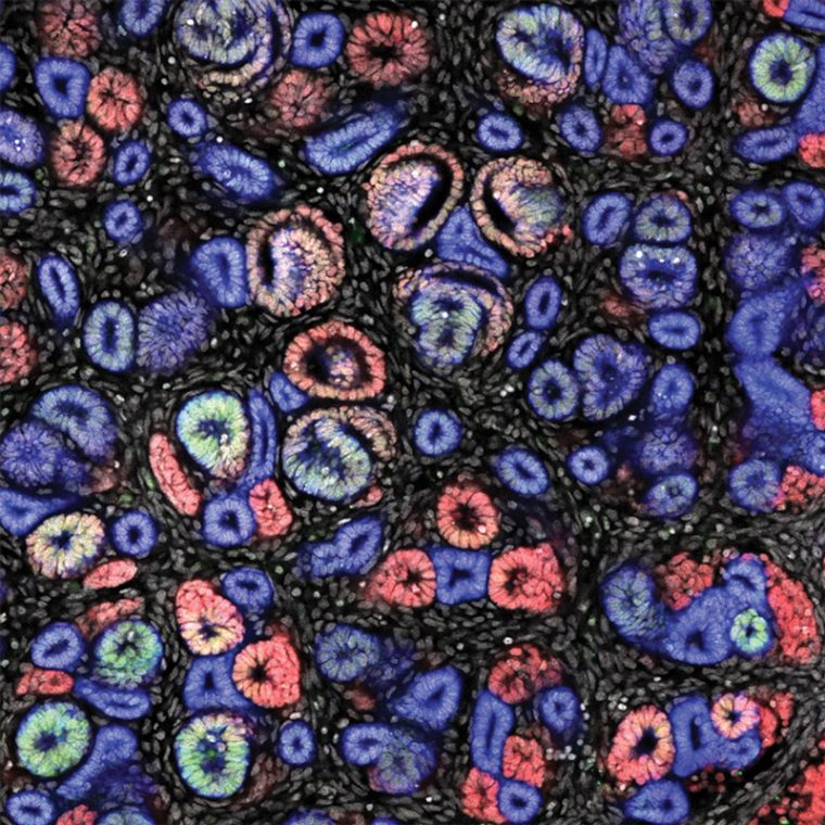 Tubular networks developing in a mammalian kidney (Image by Tracy Tran/Andy McMahon Lab)