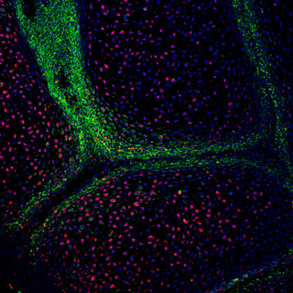 A developing metacarpal joint with skeletal stem cells (green) and mature cartilage cells (red). (Image courtesy of the Evseenko Lab)