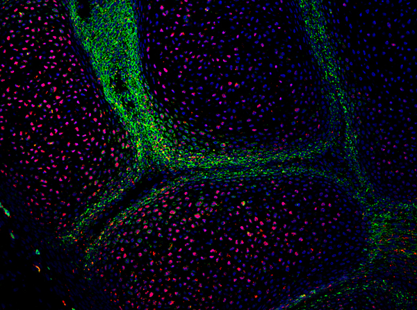 A developing metacarpal joint with skeletal stem cells (green) and mature cartilage cells (red). (Image courtesy of the Evseenko Lab)