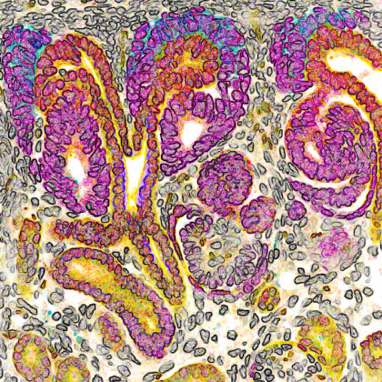Developing human nephron, the filtering unit of the kidney (Image by Nils O. Lindström and Tracy Tran/McMahon Lab)