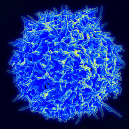 A healthy T cell (Image courtesy of the National Institute of Allergy and Infectious Diseases)