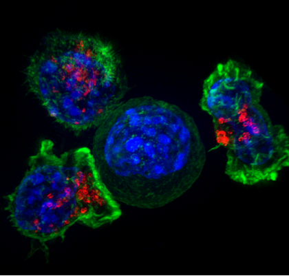 Killer T cells (green and red) surrounding a cancer cell (blue, center). (Image by Alex Ritter, Jennifer Lippincott Schwartz and Gillian Griffiths/National Institutes of Health)