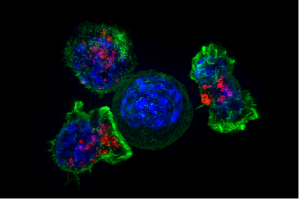 Killer T cells (green and red) surrounding a cancer cell (blue, center). (Image by Alex Ritter, Jennifer Lippincott Schwartz and Gillian Griffiths/National Institutes of Health)