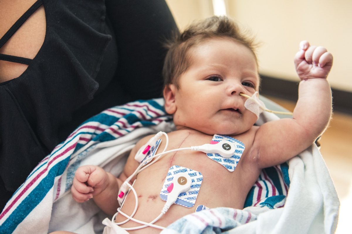 Baby Jasmine was born in late December with hypoplastic left heart syndrome (HLHS) and had her first open-heart surgery at five days old. She is enrolled in the groundbreaking clinical trial at Children’s Hospital Los Angeles. (Photo courtesy of CHLA)