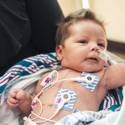 Baby Jasmine was born in late December with hypoplastic left heart syndrome (HLHS) and had her first open-heart surgery at five days old. She is enrolled in the groundbreaking clinical trial at Children’s Hospital Los Angeles. (Photo courtesy of CHLA)