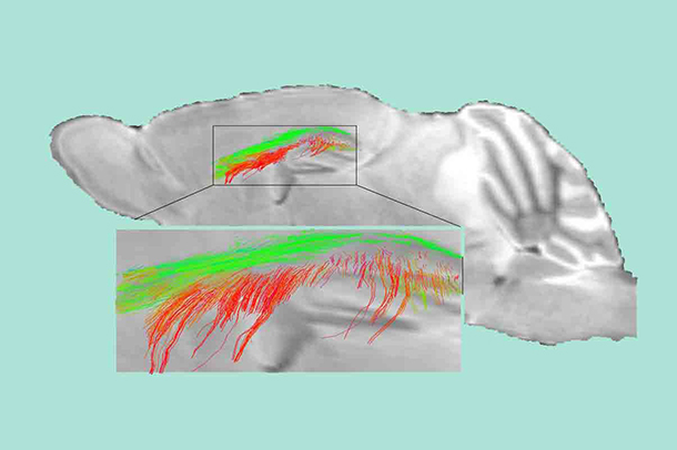 Diffusion MRI maps show disrupted white matter connectivity and loss of white matter fiber tracts in 1 year-old pericyte-deficient mice. (Image courtesy of the Zlokovic Lab)