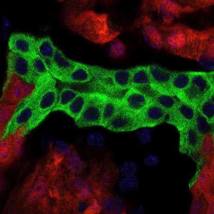 In a detailed, cell-by-cell look into the kidney, USC researchers found marked differences between the sexes. (Image courtesy of the McMahon Lab)