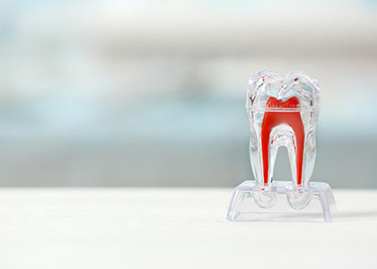 The discovery could change the way dental implants are placed, allowing dentists to regenerate tooth roots that better integrate with jaw bone structures.