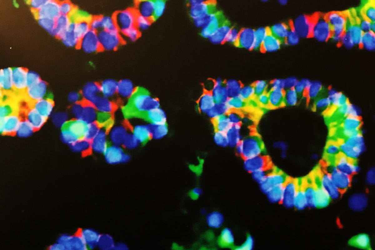 Fluorescent image of intestinal stem and progenitor cells. Cells like these can grow into engineered intestinal tissue in the laboratory. Eventually, Dr. Grikscheit hopes engineered intestine can help babies born with severe gastrointestinal challenges.