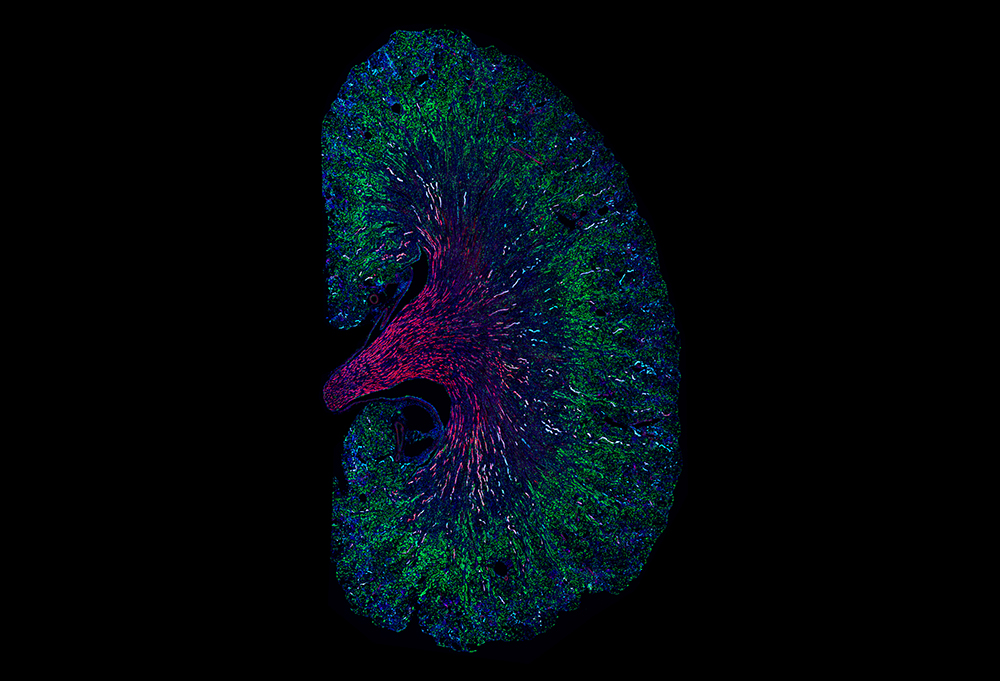 A mouse kidney one month after acute injury. Cells that proliferated in response to the injury are shown in green. (Image by Louisa M. S. Gerhardt/McMahon Lab)
