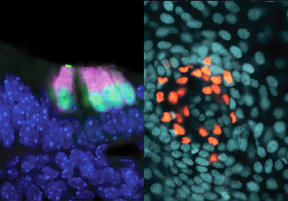 Inner ear sensory cells (left) and skin sensory cells from a one-day-old mouse