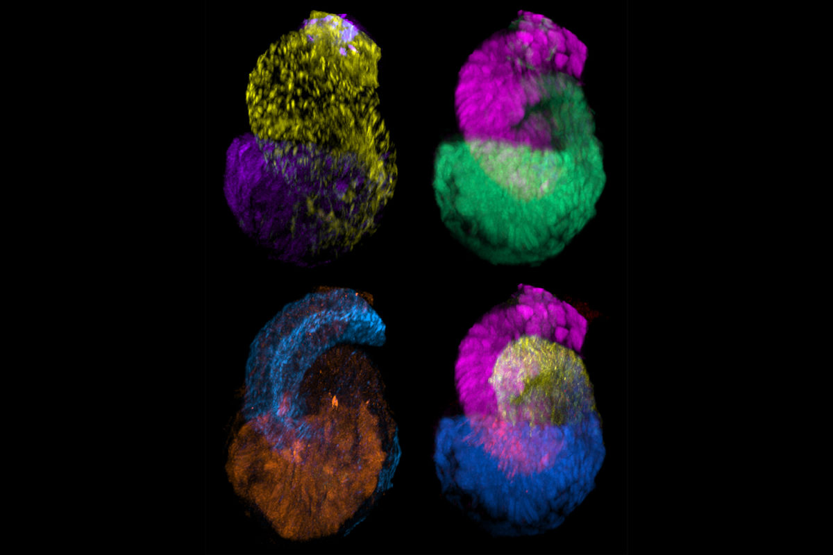 By superimposing images of several of the kidney’s filtering units, known as nephrons, researchers can visualize how little these structures deviate from a stereotypical developmental trajectory.