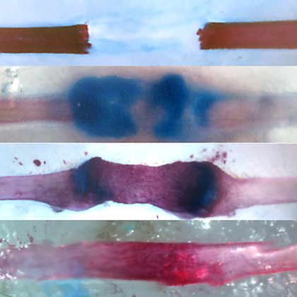 After surgical rib resection (top), a cartilage and bone bridge form (second from top) and then resolve (third from top) and remodel to regenerate the missing tissue in the gap (bottom). Blue shows cartilage matrix; red shows mineralized matrix. (Images by Stephanie Kuwahara and Max Serowoky/ Mariani Lab)