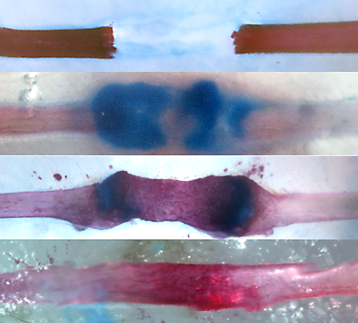 After surgical rib resection (top), a cartilage and bone bridge form (second from top) and then resolve (third from top) and remodel to regenerate the missing tissue in the gap (bottom). Blue shows cartilage matrix; red shows mineralized matrix. (Images by Stephanie Kuwahara and Max Serowoky/ Mariani Lab)