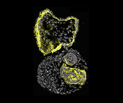 Human cystic kidney organoid (Image by Cheng (Jack) Song/McMahon Lab)