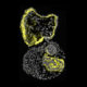 Human cystic kidney organoid (Image by Cheng (Jack) Song/McMahon Lab)