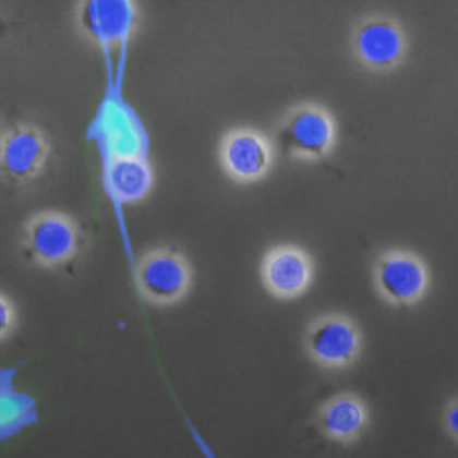 A neutrophil expels chromatin to ensnare and destroy a pathogen (Ryan Lu/Benayoun Lab)