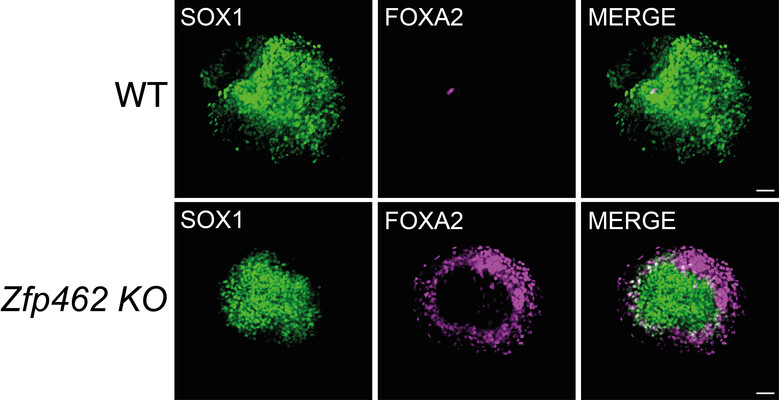 Neuronal specification is compromised in Zfp462 deleted cells. Immunofluorescence images of wildtype (WT) and Zfp462 deleted (Zfp462 KO) cells during neural differentiation. The neuronal lineage marker SOX1 is shown in green and the endodermal lineage marker FOXA2 is in magenta. Non-neural cells are detected during the neural differentiation of Zfp462 KO cells. © Bell Lab / NCB /IMBA.