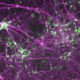 Human induced motor neurons. Motor neurons are green, and neurons are purple. (Image courtesy of the Ichida Lab)