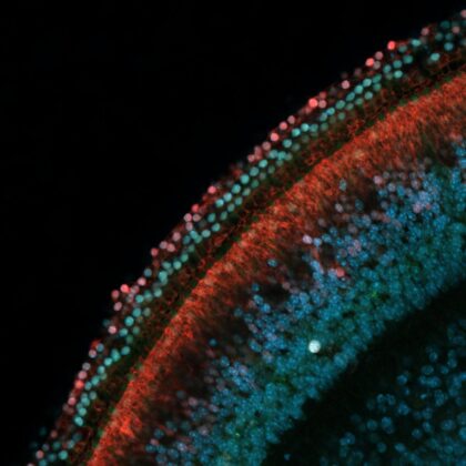 Rows of sensory hearing cells (green) next to supporting cells (red) in the inner ear of a mouse (Image by John Duc Nguyen and Juan Llamas/Segil Lab)