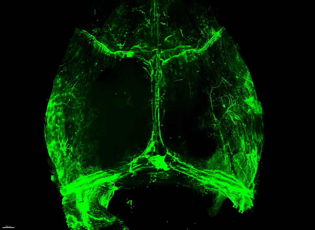 a-new-way-to-treat-craniosynostosis-usc-stem-cell