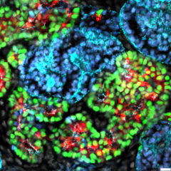 Kidney organoids with proximal tubules (Image by Jack Schnell/Lindström Lab)