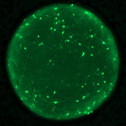 Organoid with neurons labeled in green (Image by Joshua Berlind/Ichida Lab)