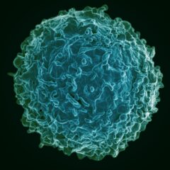 Adaptive immune cells, such as B cells (pictured), are a key component of a youthful immune system. (Image courtesy of the National Institutes of Allergy and Infectious Diseases)