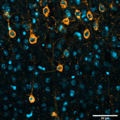 Tau protein in the brain of a mouse with a mutation that causes a common form of dementia (Image by Joshua Berlind/Ichida Lab/USC Stem Cell)