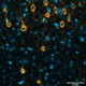 Tau protein in the brain of a mouse with a mutation that causes a common form of dementia (Image by Joshua Berlind/Ichida Lab/USC Stem Cell)