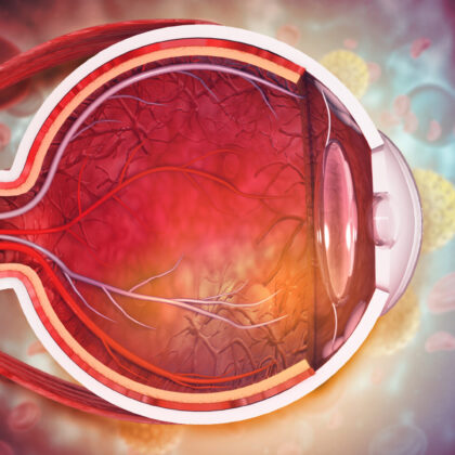 Eye (Image courtesy of iStock); featured image for $6 million grant drives potential treatment for common cause of vision loss toward the clinic
