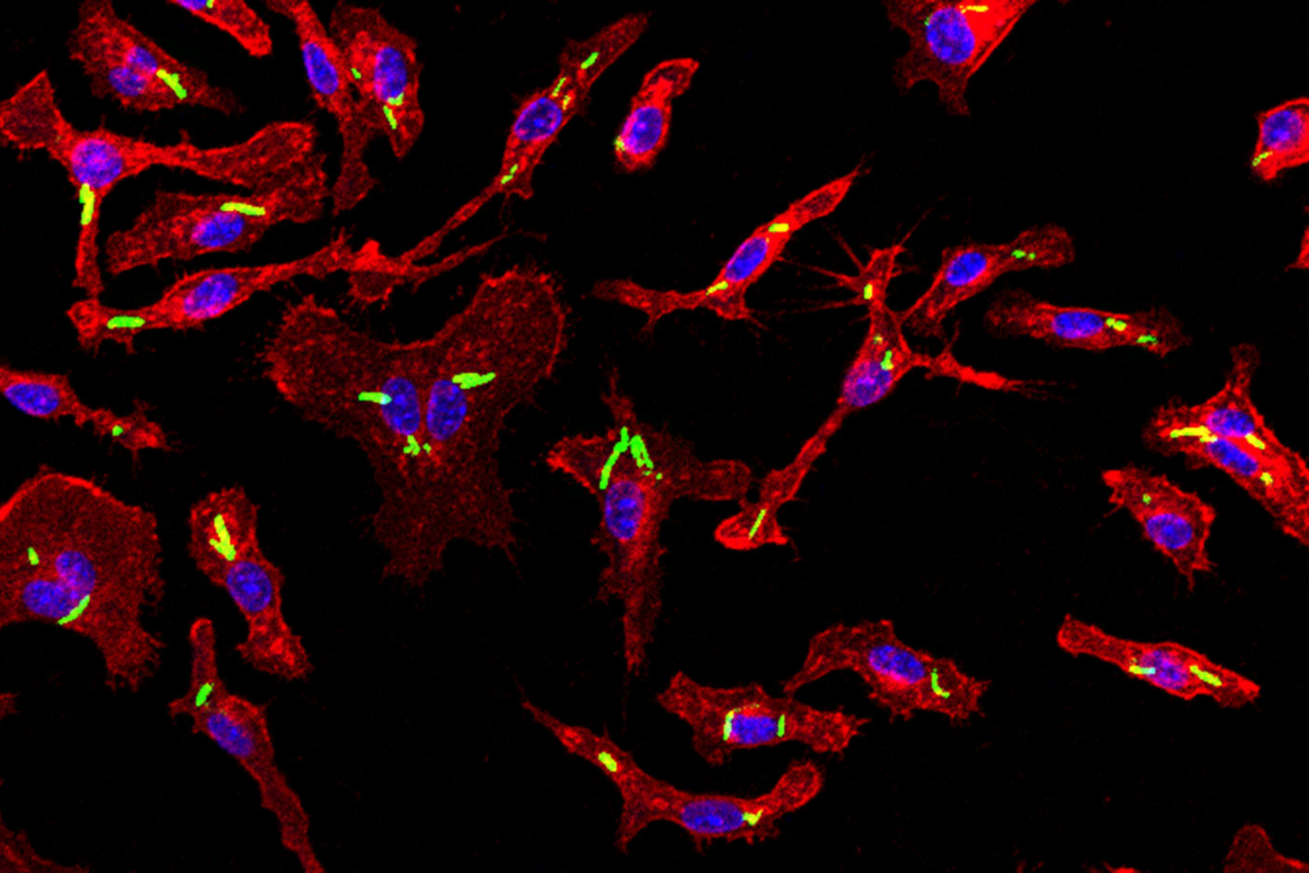 Bacterial phagocytosis by macrophages derived from ex vivo expanded stem cells. Green: E. coli; red: macrophages. (Image by Shi (Steve) Yue)
