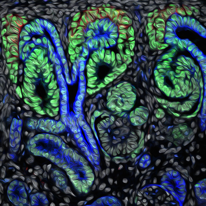 Kidney (Image by Nils Lindström)