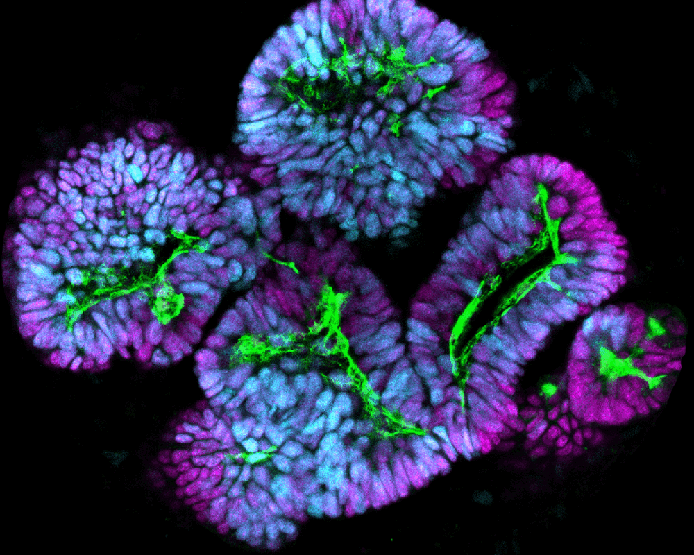 Controlling how pluripotent stem cells make kidneys. Fluorescent image of stem cell-derived nephrons, the filtering units of the kidney. (Image by MaryAnne Achieng/Lindström Lab/USC Stem Cell)