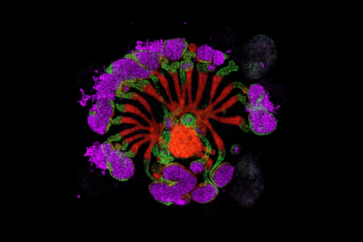 Lab grown human kidney assembloid showing the formation of radial nephrons connected to a central collecting system. (Image by Pedro Medina/Li Lab/USC Stem Cell)