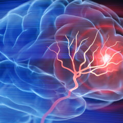 Brain